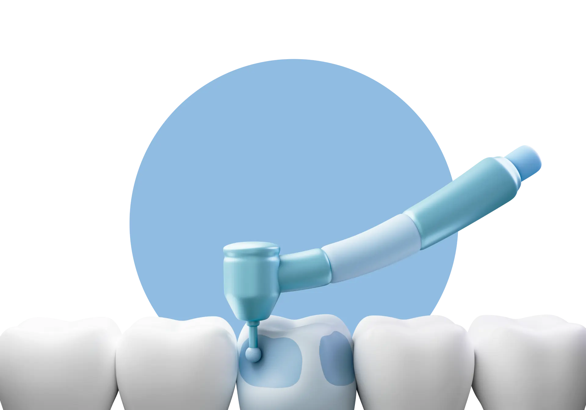 Kids Dental, Kids Dental Corner, Pediatric Dental Services