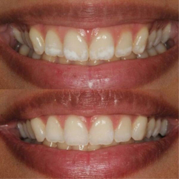 Kids Dental, Kids Dental Corner, Pediatric Dental Services