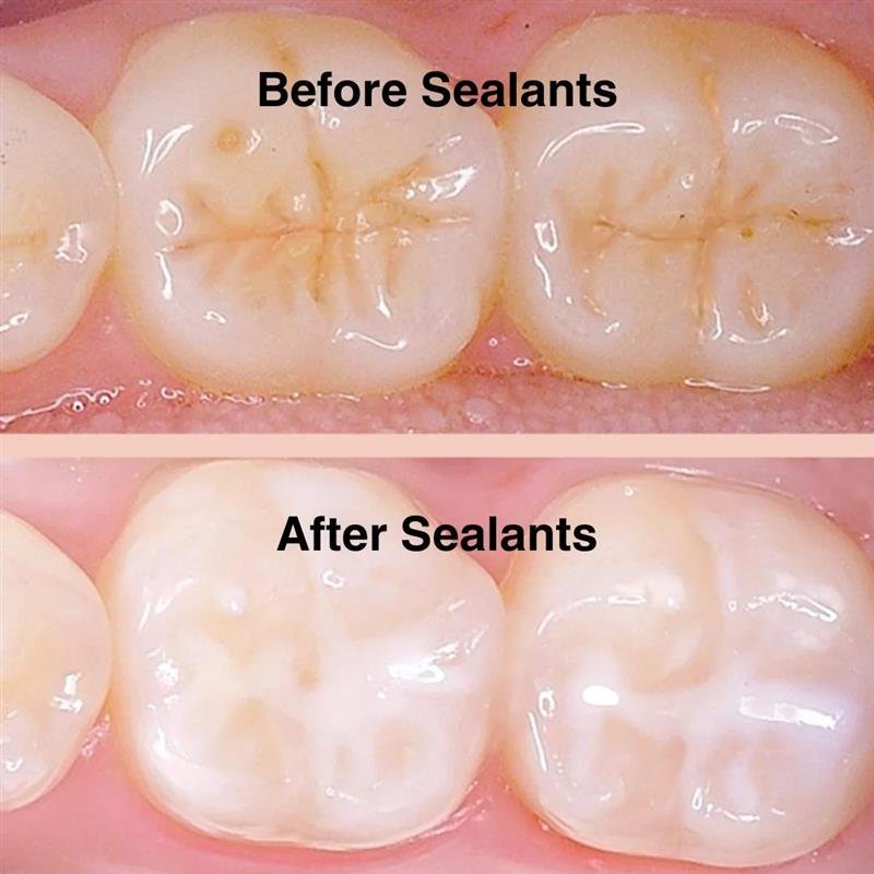 Kids Dental, Kids Dental Corner, Pediatric Dental Services
