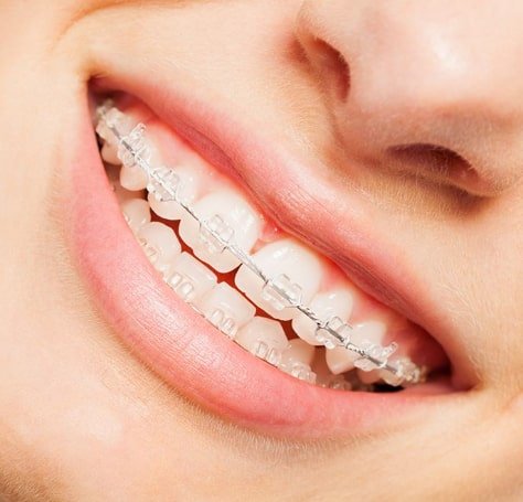 Kids Dental, Kids Dental Corner, Pediatric Dental Services