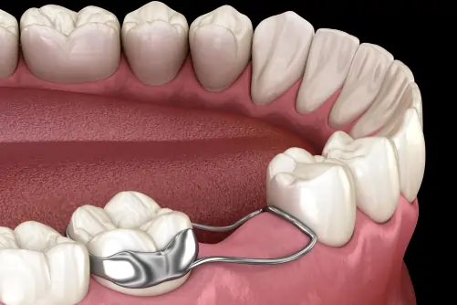 Kids Dental, Kids Dental Corner, Pediatric Dental Services