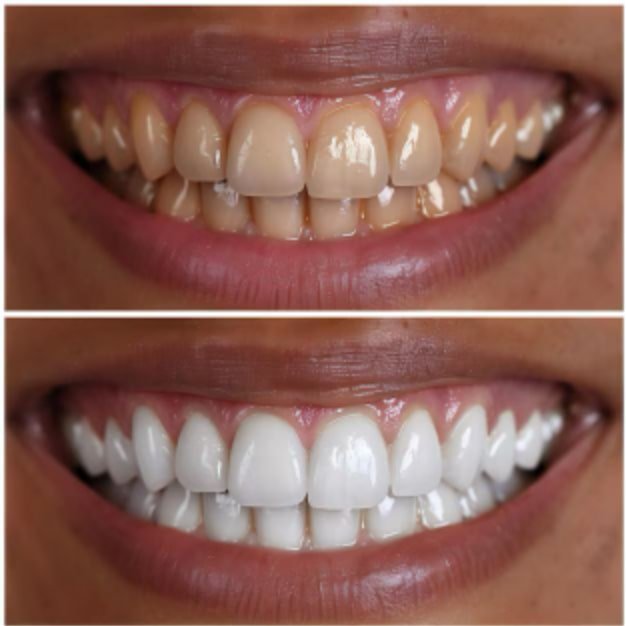 Kids Dental, Kids Dental Corner, Pediatric Dental Services