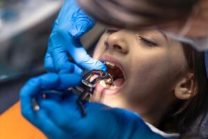 Kids Dental Corner | Baby Mouth Injuries Explained: What Parents Should Do for Infants Under Two Baby Mouth