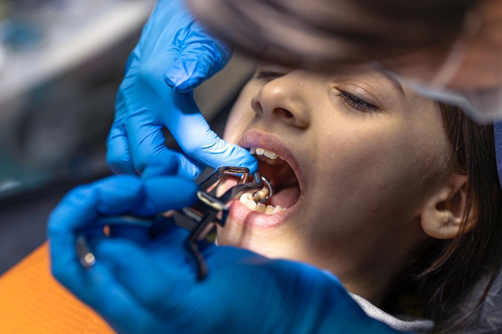 Kids Dental Corner | Baby Mouth Injuries Explained: What Parents Should Do for Infants Under Two Baby Mouth